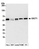 Detection of human and mouse OXCT1 by we