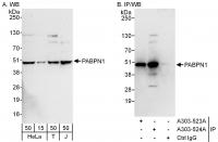 Detection of human PABPN1 by western blo