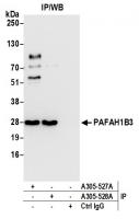 Detection of human PAFAH1B3 by western b