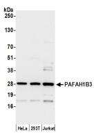 Detection of human PAFAH1B3 by western b