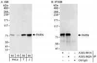 Detection of human PARN by western blot 