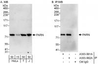 Detection of human PARN by western blot 