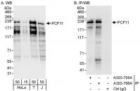 Detection of human PCF11 by western blot