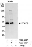 Detection of human PDCD2 by western blot