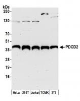 Detection of human and mouse PDCD2 by we