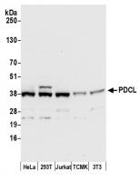 Detection of human and mouse PDCL by wes