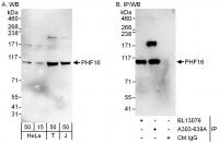 Detection of human PHF16 by western blot