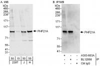Detection of human PHF21A by western blo