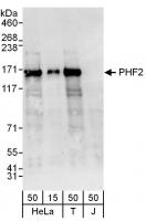 Detection of human PHF2 by western blot.