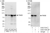 Detection of human PI4KB by western blot