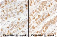 Detection of human PKM2 by immunohistoch