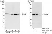 Detection of human and mouse PKM2 by wes