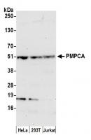 Detection of human PMPCA by western blot