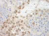 Detection of mouse POGZ by immunohistoch