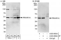Detection of human PRKAR1A by western bl