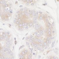 Detection of human PTPN12 in FFPE mammar