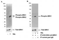 Detection of human phospho-ERK1 and ERK2
