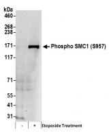 Detection of human Phospho SMC1 (S957) b