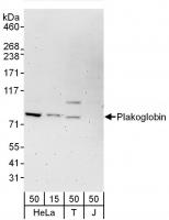 Detection of human Plakoglobin by wester