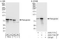 Detection of human Plakoglobin by wester