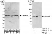 Detection of human and mouse Pur-alpha b