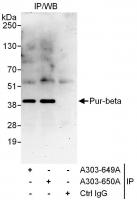 Detection of human Pur-beta by western b