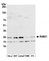 Detection of human and mouse RAB21 by we