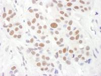 Detection of human RAP1 by immunohistoch