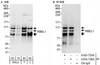 Detection of human RBEL1 by western blot