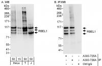 Detection of human RBEL1 by western blot