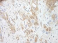 Detection of human RECQ5 by immunohistoc