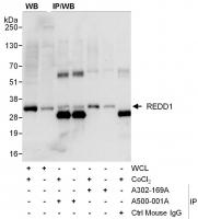 Detection of human REDD1 by western blot