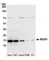 Detection of human and mouse REEP5 by we