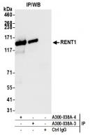 Detection of human RENT1 by western blot
