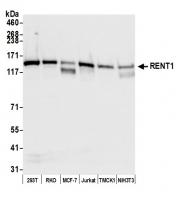 Detection of human RENT1 by western blot