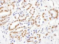 Detection of human RING1 by immunohistoc