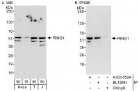 Detection of human RING1 by western blot
