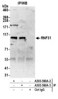 Detection of human RNF31 by western blot