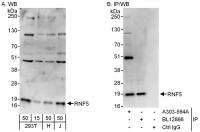 Detection of human RNF5 by western blot 