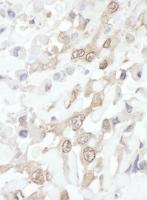 Detection of human ROC1 by immunohistoch