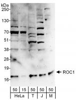 Detection of human and mouse ROC1 by wes