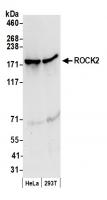 Detection of human ROCK2 by western blot