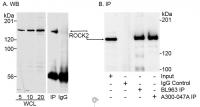 Detection of human ROCK2 by western blot