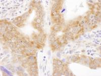 Detection of human RPL6 by immunohistoch