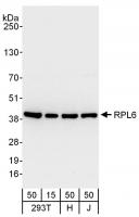 Detection of human RPL6 by western blot.