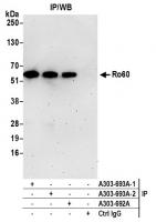 Detection of human Ro60 by western blot 