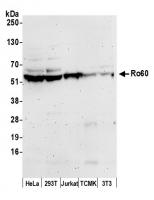 Detection of human and mouse Ro60 by wes
