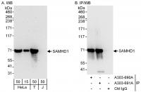 Detection of human SAMHD1 by western blo