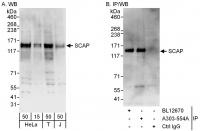 Detection of human SCAP by western blot 
