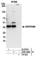 Detection of human SERPINB6 by western b